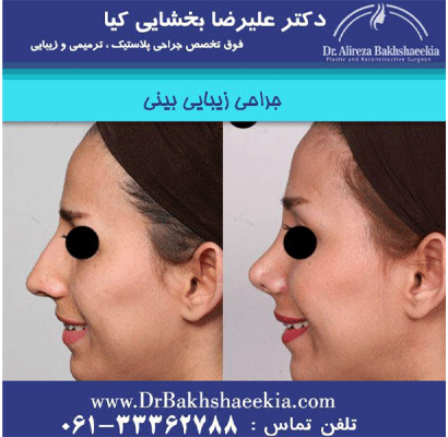عمل-بینی