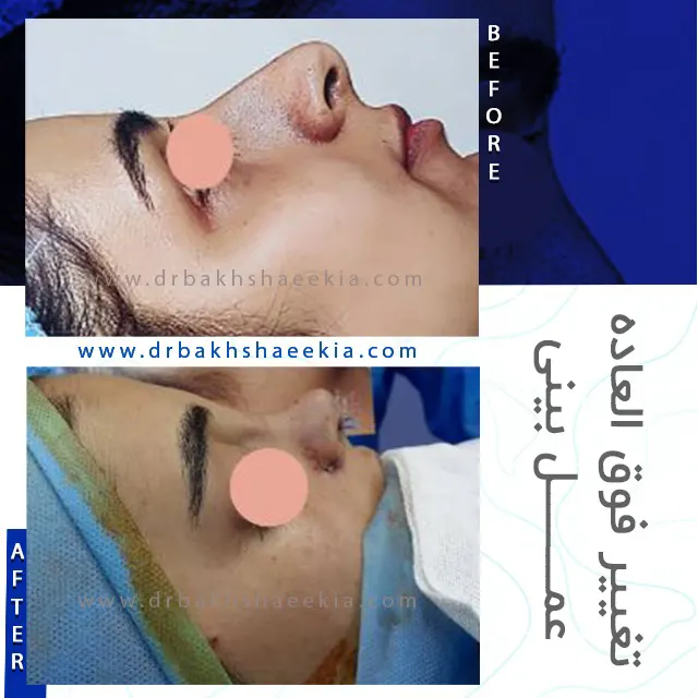 نمونه کار دکتر بخشایی کیا