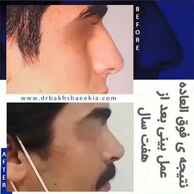 نمونه کار دکتر بخشایی کیا