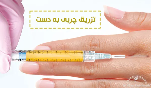 تزریق چربی به دست