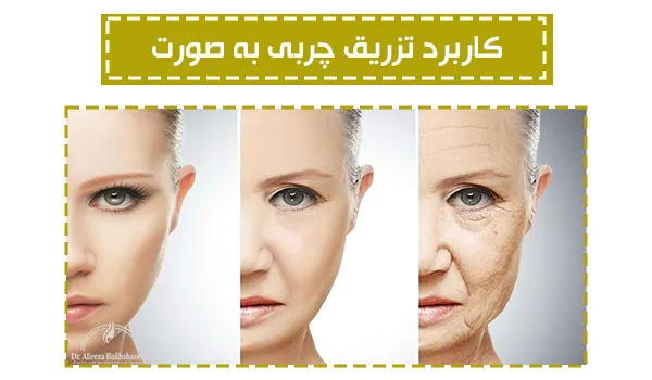 کاربرد تزریق چربی به صورت
