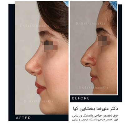جراحی-بینی-فانتزی