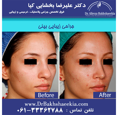 عمل-بینی-فانتزی