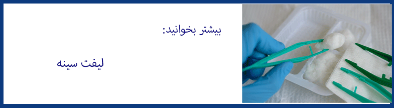 عمل-ماموپلاستی