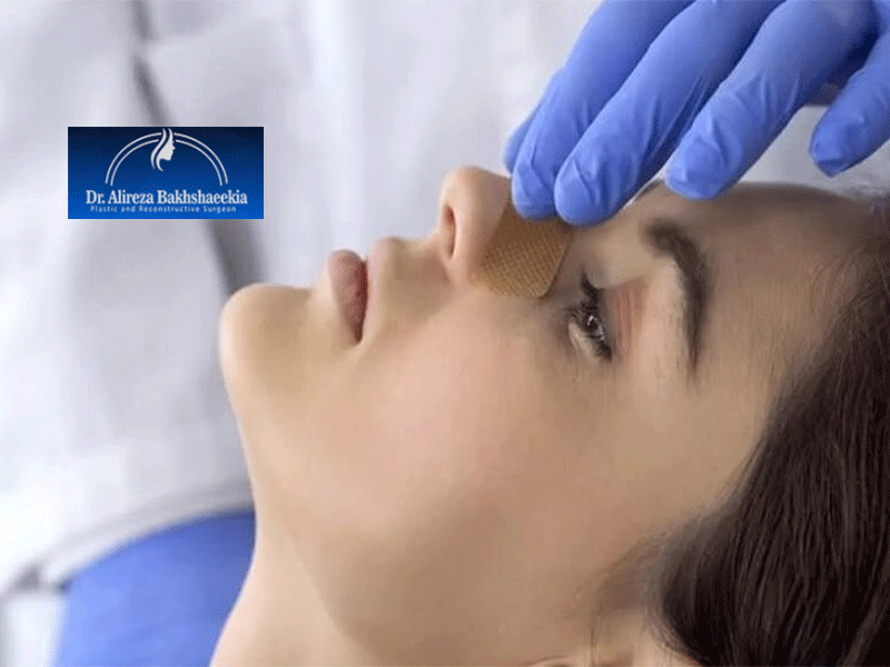 10 مورد از مهم ترین مراقبت های بعد از جراحی بینی